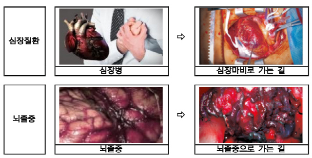 제5기 경고그림 및 문구 표기내용(안). <보건복지부 제공>